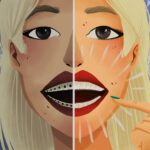 invisalign clear aligners vs traditional braces