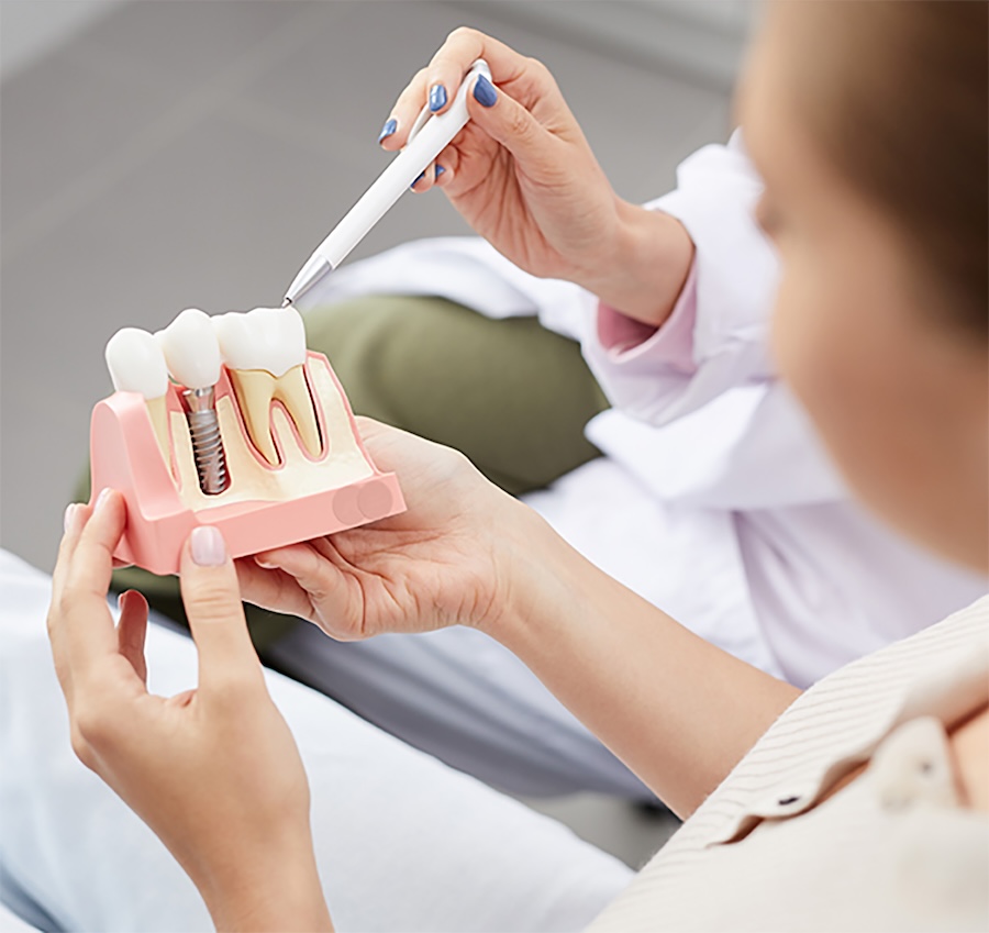 dental implant consultation