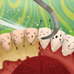 deep cleaning removing bacteria deposits, plaque, tartar, gum disease